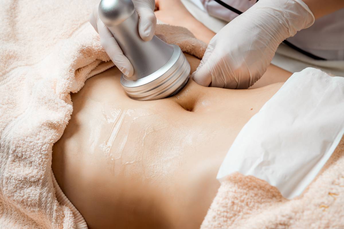 Fat Reduction with Cryo Maxi Lipo in Bartlett, IL targeting abdominal contouring